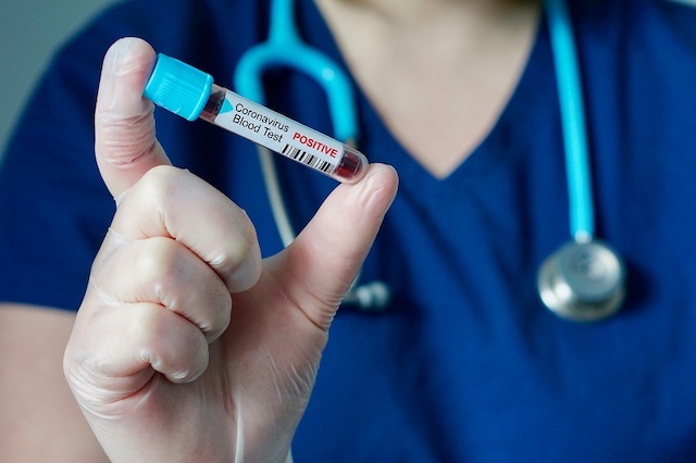 Coronavirus, accertati 13 casi in un giorno. Nella Tuscia sono 57