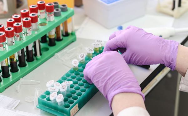 Covid-19, due nuove positività. Salgono a 4 i casi a Monteleone d'Orvieto