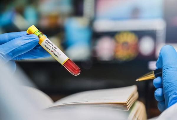 Coronavirus, ad Orvieto sono 45 le persone ufficialmente guarite