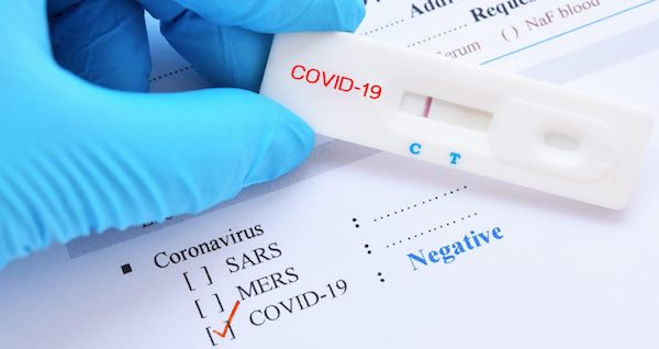 Coronavirus, salgono a 404 i guariti nella Tuscia