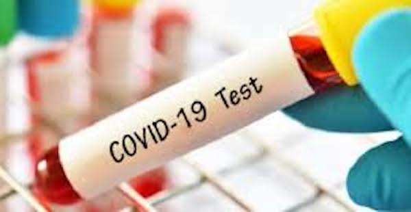 Covid-19, in provincia di Viterbo accertati 75 casi