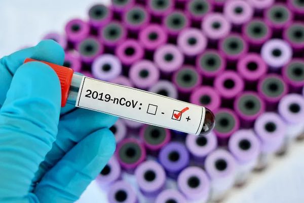 Coronavirus: 28 gli orvietani positivi, 18 sono in isolamento contumaciale
