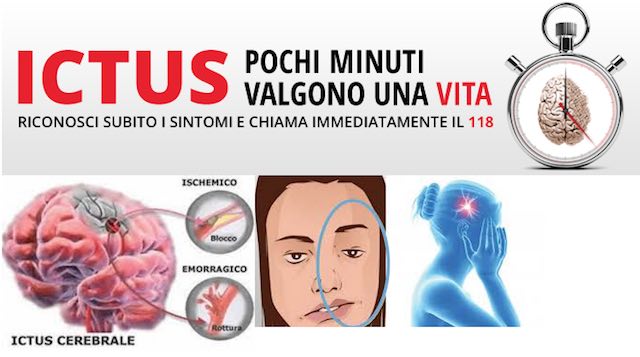 Ictus, un disturbo in crescente e preoccupante aumento