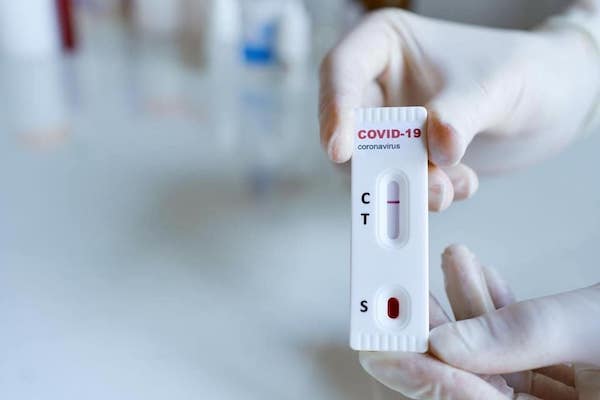 Test sierologici pungidito per i residenti nella frazione di Frattuccia