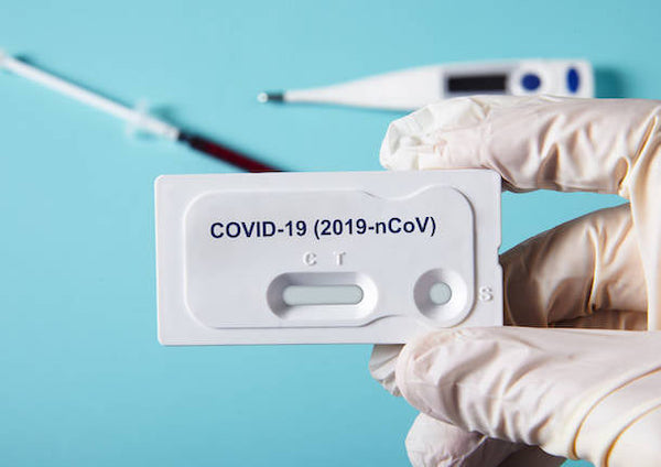 Due giornate di screening mediante test sierologici rapidi anche a Castel Viscardo